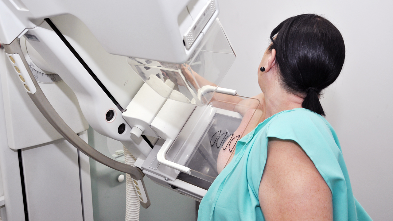 Entenda a Importância da Mamografia Para a Sua Saúde 3