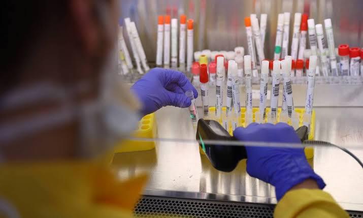 Lacen confirma que 50 amostras de Sinop para identificar coronavírus foram conferidas e serão testadas esta semana 3