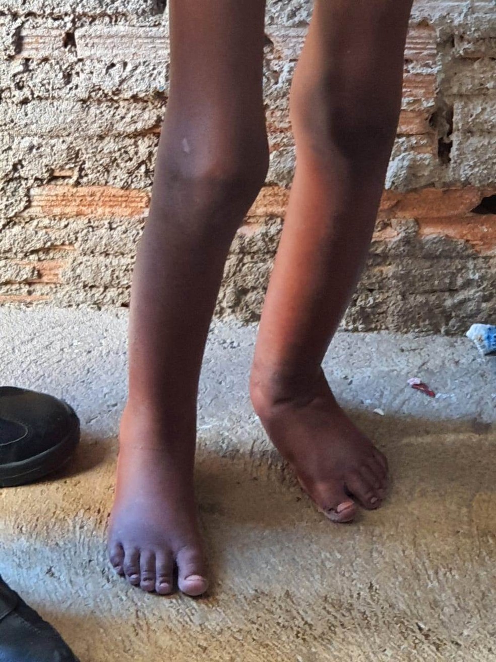 Polícia resgata menino de 11 anos torturado vivendo em barril 4
