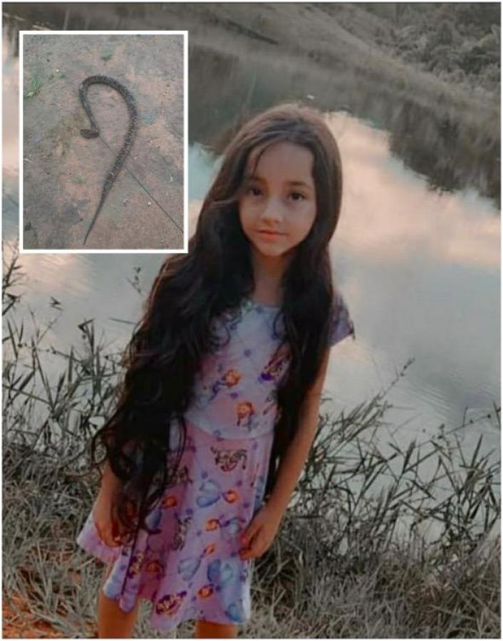 TRAGÉDIA: Picada de cobra mata criança de 8 anos
