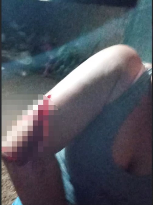 SINOP: Mulher é hospitalizada após levar golpe de faca do próprio Marido