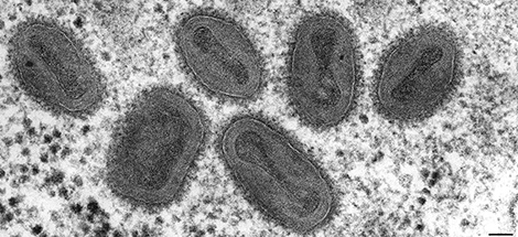 Primeiro caso suspeito de varíola de macacos é registrado em Mato Grosso