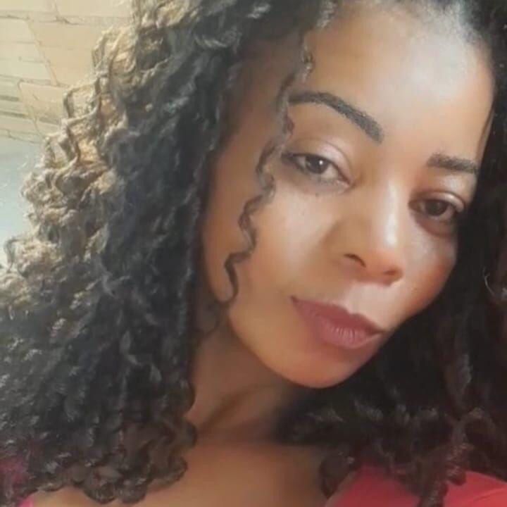 Mulher queimada pelo ex-marido, não resiste e morre após 10 dias internada